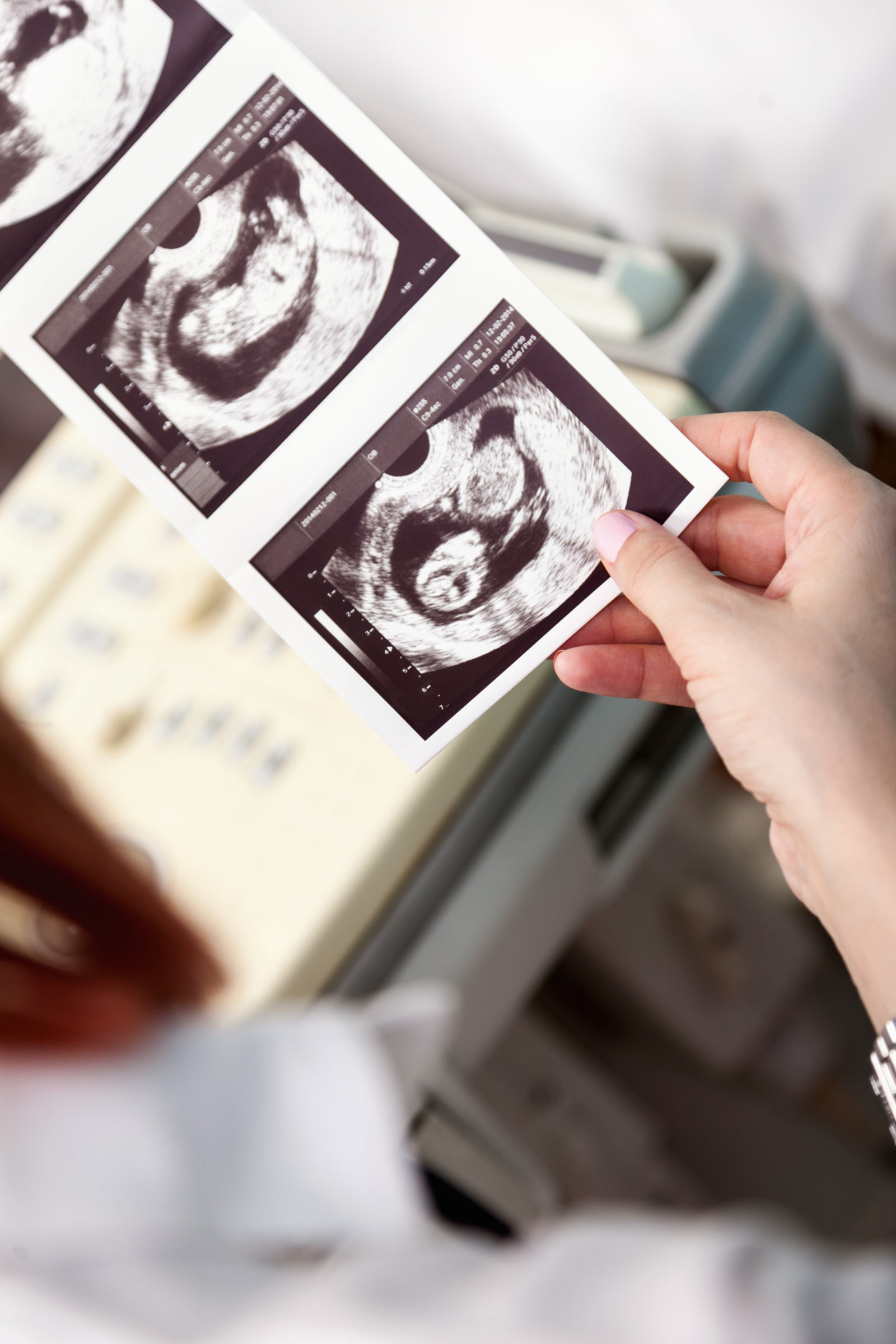 Woman Looking Ultrasound Scan Of Baby